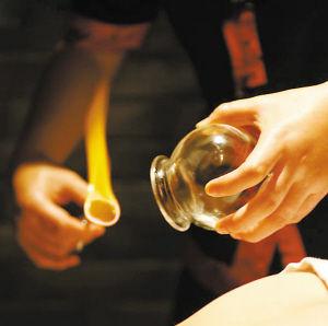 火罐不能随意拔