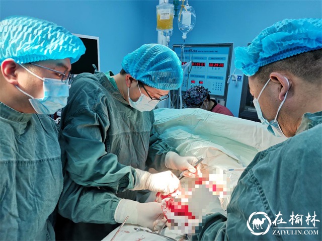 中大医院援米胸心外科专家蒲振业：开展胸腔镜手术迫在眉睫